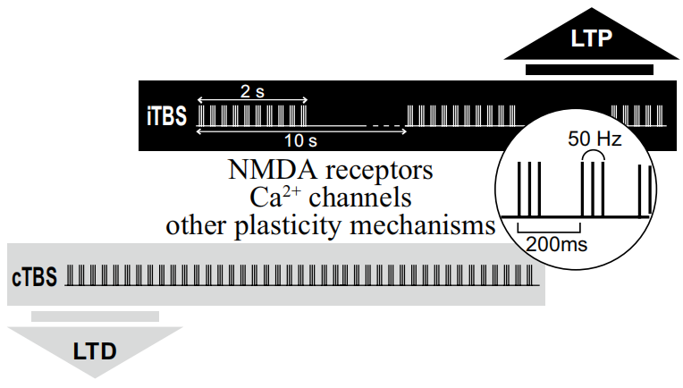 Definition of theta burst stimulation