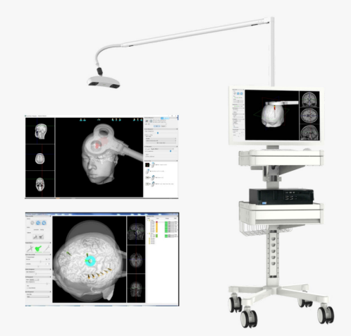 TMS 3D Navigation System -Quick Vision