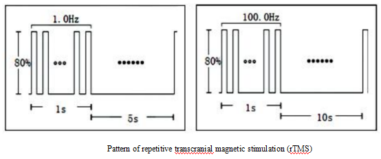 pattern of rtms