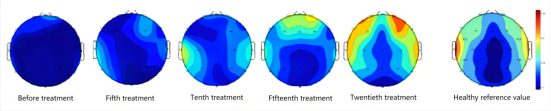 Increased brain flexibility