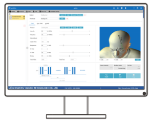 TMS QUICKSTIM Software