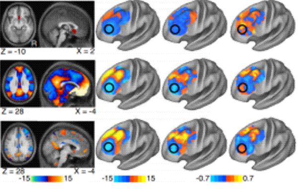 TMS Combined with fMRI