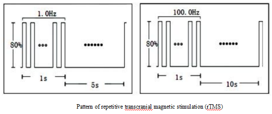 Pattern of repetitive transcranial magnetic stimulation (rTMS)