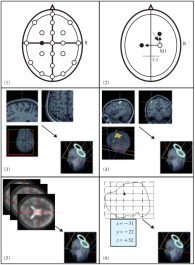 six coil positioning methods