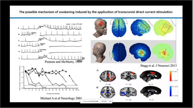 the application of transcranial direct current stimulation